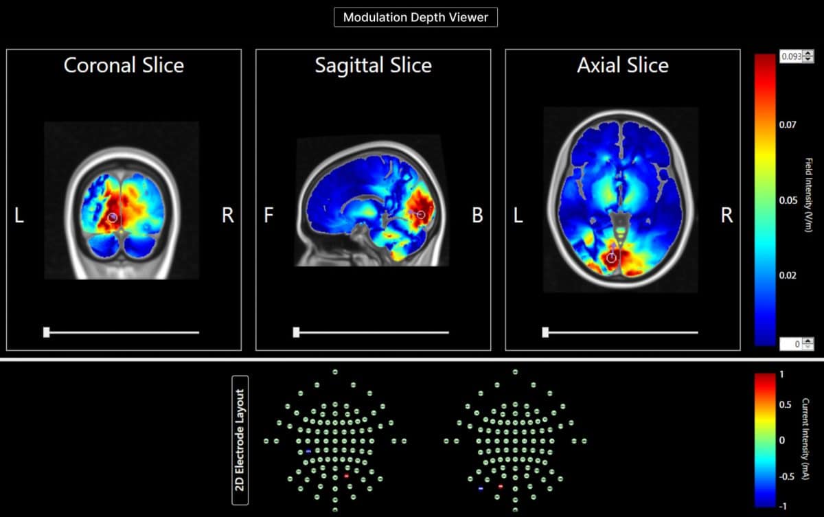 Treatments driven by the science of brain mapping